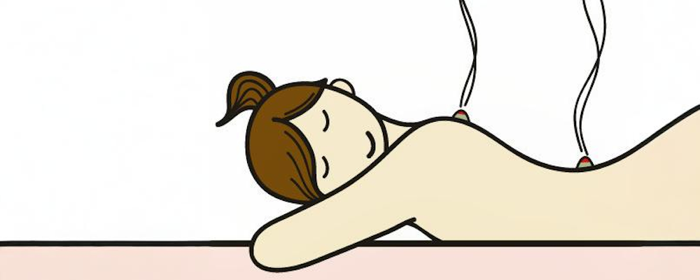 女性鍼灸師